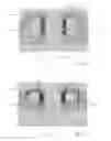 Fig. 06 - Induction sealing device and method of sealing a packaging material using said induction sealing device