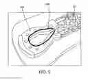 Fig. 17 - Insulating device and method for forming insulating device