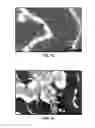 Fig. 09 - Synthesis and processing of novel phase of carbon (Q-carbon)