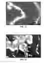 Fig. 09 - Synthesis and processing of pure and NV nanodiamonds and other nanostructures
