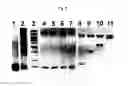 Fig. 03 - RECOMBINANT EXPRESSION OF MULTIPROTEIN COMPLEXES USING POLYGENES
