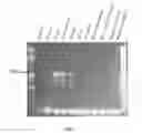 Fig. 03 - STY PEPTIDES FOR INHIBITION OF ANGIOGENESIS
