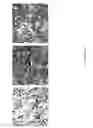 Fig. 05 - Methods for treating Janus kinase-associated disorders by administering soluble transforming growth factor beta type II receptor
