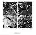 Fig. 09 - Methods for treating Janus kinase-associated disorders by administering soluble transforming growth factor beta type II receptor