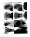 Fig. 01 - Novel Brain Chemokine Samdori and Use Thereof