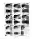 Fig. 04 - Novel Brain Chemokine Samdori and Use Thereof