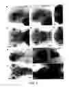 Fig. 05 - Novel Brain Chemokine Samdori and Use Thereof