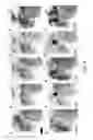 Fig. 06 - Novel Brain Chemokine Samdori and Use Thereof