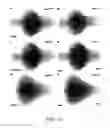 Fig. 14 - Novel Brain Chemokine Samdori and Use Thereof