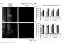Fig. 16 - Novel Brain Chemokine Samdori and Use Thereof