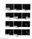 Fig. 07 - Anti-MCAM antibodies and associated methods of use
