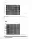 Fig. 06 - Methods of treatment using recombinant oxalate oxidase