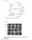 Fig. 09 - Methods of treatment using recombinant oxalate oxidase