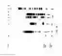 Fig. 15 - DNA amplification and sequencing using DNA molecules generated by random fragmentation