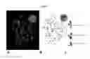 Fig. 02 - Chromosomal assessment to differentiate histiocytic malignancy from lymphoma in dogs