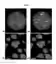 Fig. 03 - Chromosomal assessment to differentiate histiocytic malignancy from lymphoma in dogs