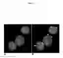 Fig. 04 - Chromosomal assessment to differentiate histiocytic malignancy from lymphoma in dogs