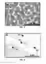 Fig. 07 - Synthesis and processing of Q-carbon, graphene, and diamond