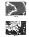 Fig. 09 - Synthesis and processing of Q-carbon, graphene, and diamond