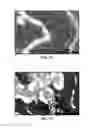 Fig. 09 - DIRECT CONVERSION OF CARBON INTO DIAMOND AND STRUCTURES FOR A VARIETY OF APPLICATIONS