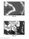 Fig. 09 - Synthesis and processing of novel phase of boron nitride (Q-BN)