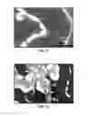 Fig. 09 - CONVERSION OF BORON NITRIDE INTO N-TYPE AND P-TYPE DOPED CUBIC BORON NITRIDE AND STRUCTURES