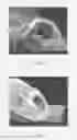 Fig. 03 - PROCESS FOR IMPROVING THE CHEMICAL AND/OR PHYSICAL PROPERTIES OF HOLLOW-STRUCTURE NATURAL FIBERS
