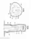 Fig. 04 - BACKWARD WHIRLING REDUCTION
