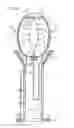 Fig. 04 - Fluid pump having a radially compressible rotor