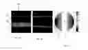 Fig. 07 - Particle analyzing systems and methods using acoustic radiation pressure