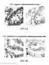 Fig. 07 - G-Alpha Interacting Vesicle Associated Protein (GIV) as a Predictive Marker in Stage II Colorectal Cancer