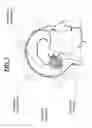 Fig. 04 - Method and apparatus for prospective motion correction using volume navigators in magnetic resonance imaging
