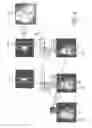 Fig. 07 - Magnetic resonance imaging with motion correction suing pre-pulses and navigators