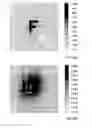 Fig. 08 - Multi-focal lens