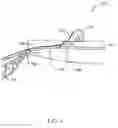 Fig. 02 - Pipe-conforming structure
