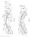 Fig. 22 - CONTACT LENSES FOR REFRACTIVE CORRECTION