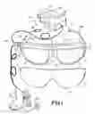 Fig. 02 - Enhanced-reality electronic device for low-vision pathologies, and implant procedure