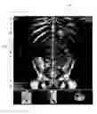 Fig. 01 - Display of 3D images