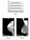 Fig. 06 - Database systems and interactive user interfaces for dynamic interaction with, and review of, digital medical image data