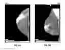 Fig. 07 - Database systems and interactive user interfaces for dynamic interaction with, and review of, digital medical image data