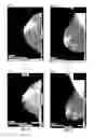 Fig. 09 - Database systems and interactive user interfaces for dynamic interaction with, and review of, digital medical image data