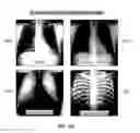 Fig. 14 - Database systems and interactive user interfaces for dynamic interaction with, and review of, digital medical image data