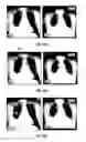 Fig. 19 - Database systems and interactive user interfaces for dynamic interaction with, and review of, digital medical image data