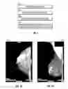 Fig. 06 - Database systems and interactive user interfaces for dynamic interaction with, and indications of, digital medical image data