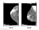 Fig. 07 - Database systems and interactive user interfaces for dynamic interaction with, and indications of, digital medical image data