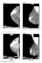 Fig. 09 - Database systems and interactive user interfaces for dynamic interaction with, and indications of, digital medical image data