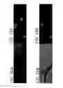Fig. 41 - SYSTEMS AND METHODS FOR AUTOMATED DETECTION OF REGIONS OF INTEREST IN RETINAL IMAGES