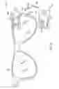 Fig. 04 - Head mounted display device for use in a medical facility