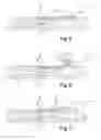 Fig. 03 - Method for fabricating an electronic/electrical circuit device