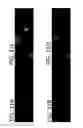 Fig. 41 - SYSTEMS AND METHODS FOR ENHANCEMENT OF RETINAL IMAGES